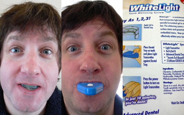 Teeth whitening
